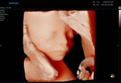 USG  w poradni ginekologicznej w Zambrowie – badanie połówkowe