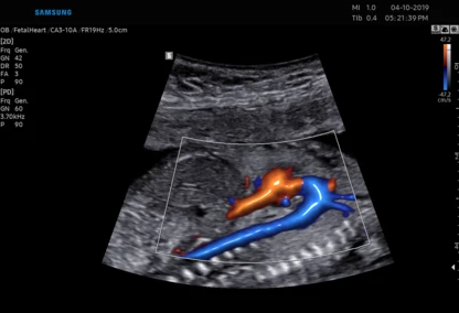 nowoczesna diagnostyka obrazowa w Zambrowie